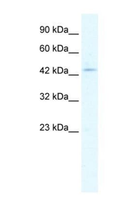 CLIC5 Antibody, Novus Biologicals 0.1mg; Unlabeled:Antibodies, Polyclonal