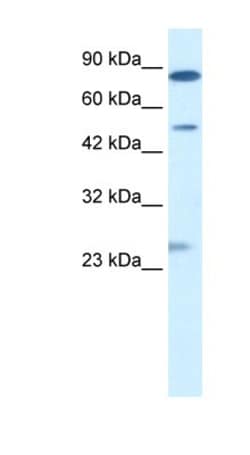 CLIC6 Antibody, Novus Biologicals 100μL; Unlabeled:Antibodies, Polyclonal