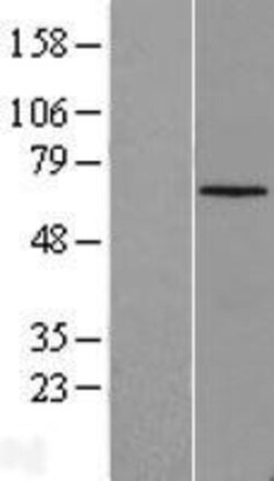 Novus Biologicals&trade;&nbsp;CLIP3 Overexpression Lysate