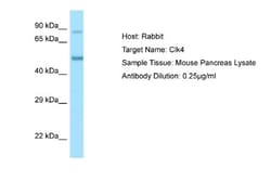 CLK4 Antibody, Novus Biologicals 100&mu;L; Unlabeled:Antibodies, Polyclonal