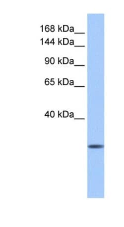 CLMN Antibody, Novus Biologicals:Antibodies:Primary Antibodies