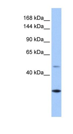 CLMN Antibody, Novus Biologicals 100&mu;L; Unlabeled:Antibodies, Polyclonal