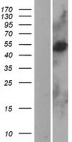 Novus Biologicals&trade;&nbsp;CLN3 Overexpression Lysate