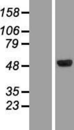 Novus Biologicals&trade;&nbsp;CLN5 Overexpression Lysate