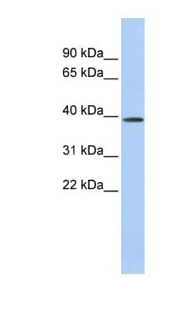 CLN6 Antibody, Novus Biologicals:Antibodies:Primary Antibodies
