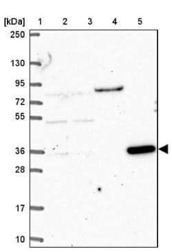 CLN6 Antibody, Novus Biologicals 0.1mL; Unlabeled:Antibodies, Polyclonal