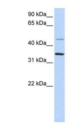 CLN6 Antibody, Novus Biologicals 0.05mg; Unlabeled:Antibodies, Polyclonal