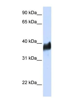 CLN8 Antibody, Novus Biologicals:Antibodies:Primary Antibodies