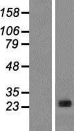 Novus Biologicals&trade;&nbsp;CLNS1A Overexpression Lysate