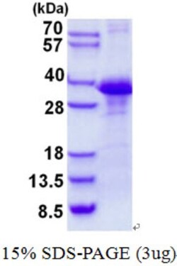 Novus Biologicals&trade;&nbsp;Recombinant Human CLNS1A His Protein