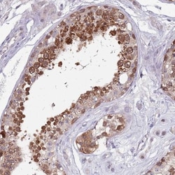 CLNS1A Antibody, Novus Biologicals 0.1mL; Unlabeled:Antibodies, Polyclonal