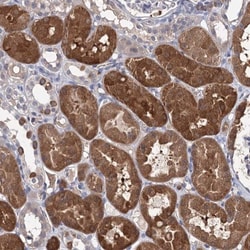 CLPB Antibody, Novus Biologicals:Antibodies:Primary Antibodies