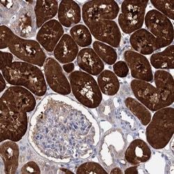 CLPB Antibody, Novus Biologicals:Antibodies:Primary Antibodies