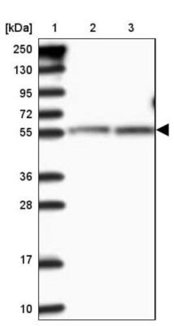 CLPB Antibody, Novus Biologicals:Antibodies:Primary Antibodies