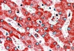 CLPP Antibody, Novus Biologicals 0.1mg; Unlabeled:Antibodies, Polyclonal