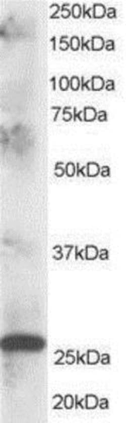 CLPP Antibody, Novus Biologicals 0.1mg; Unlabeled:Antibodies, Polyclonal