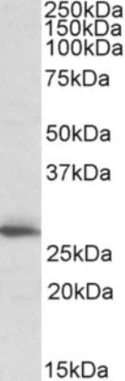 CLPP Antibody, Novus Biologicals 0.1mg; Unlabeled:Antibodies, Polyclonal