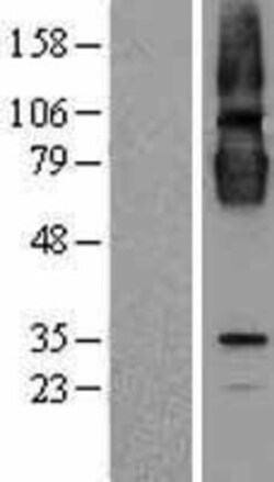 Novus Biologicals&trade;&nbsp;CLPTM1 Overexpression Lysate