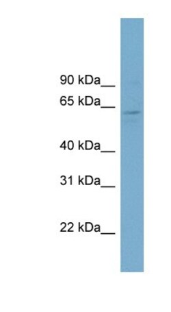 CLRN1 Rabbit anti-Human, Polyclonal, Novus Biologicals 100μL; Unlabeled:Antibodies,