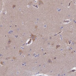 CLVS2 Antibody, Novus Biologicals 25 &mu;L; Unlabeled:Antibodies, Polyclonal
