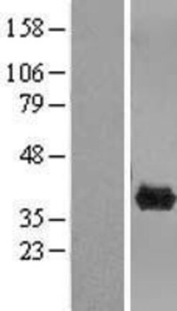 Novus Biologicals&trade;&nbsp;CLYBL Overexpression Lysate