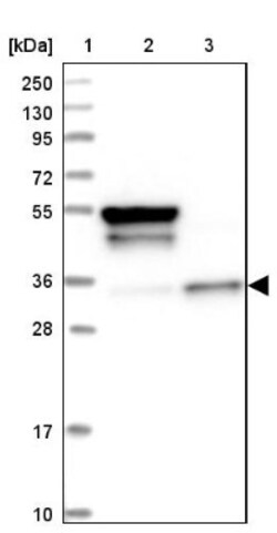 CLYBL Antibody, Novus Biologicals 0.1mL; Unlabeled:Antibodies, Polyclonal