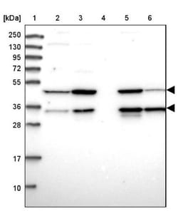 CLYBL Antibody, Novus Biologicals:Antibodies:Primary Antibodies