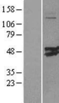 Novus Biologicals&trade;&nbsp;CMAS Overexpression Lysate