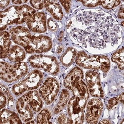 CMC1 Antibody, Novus Biologicals:Antibodies:Primary Antibodies
