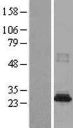 Novus Biologicals&trade;&nbsp;CML2 Overexpression Lysate