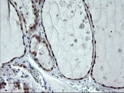 CMP kinase Antibody (OTI1A1), Novus Biologicals 0.1mL; Unlabeled:Antibodies,