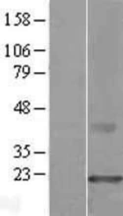 Novus Biologicals&trade;&nbsp;CMTM3 Overexpression Lysate