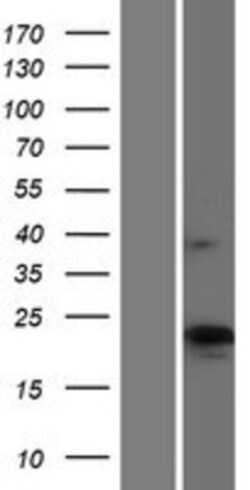 Novus Biologicals&trade;&nbsp;CMTM4 Overexpression Lysate