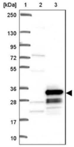 CMTM4 Antibody, Novus Biologicals 0.1mL; Unlabeled:Antibodies