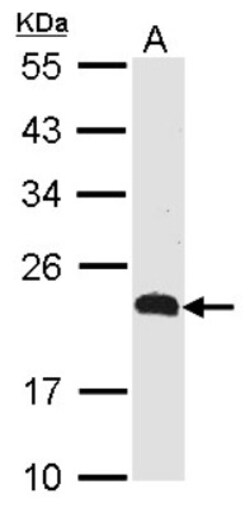 CMTM5 Antibody, Novus Biologicals 0.1mL; Unlabeled:Antibodies, Polyclonal