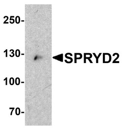 CMYA5 Antibody - BSA Free, Novus Biologicals 0.025 mg, Unconjugated:Antibodies,