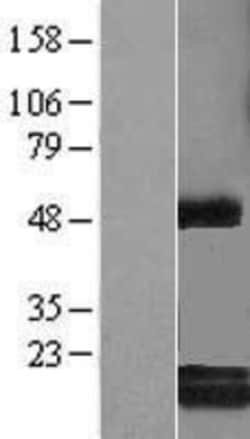 Novus Biologicals&trade;&nbsp;c-Myc-responsive protein Rcl Overexpression Lysate