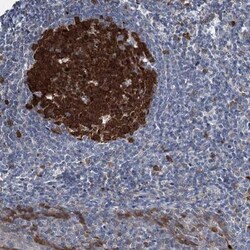 CNAP1 Antibody, Novus Biologicals:Antibodies:Primary Antibodies