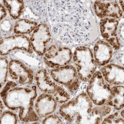 CNBD1 Antibody, Novus Biologicals 0.1mL; Unlabeled:Antibodies, Polyclonal