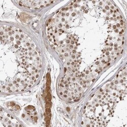 CNBD1 Antibody, Novus Biologicals 25 &mu;L, Unlabeled:Antibodies, Polyclonal