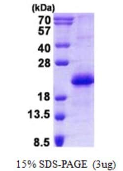 Novus Biologicals&trade;&nbsp;Recombinant Human CNBP His Protein