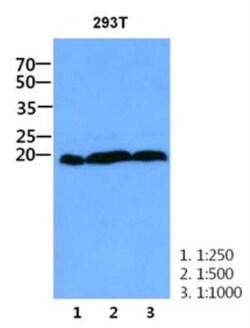 CNBP Antibody (38F10) - BSA Free, Novus Biologicals 100 &mu;L | Buy Online | Novus Biologicals | Fisher Scientific