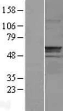 Novus Biologicals&trade;&nbsp;Carnosine Dipeptidase 1/CNDP1 Overexpression Lysate