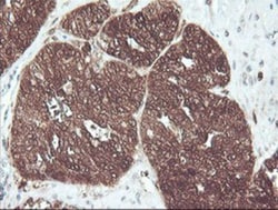 Cytosol Nonspecific Dipeptidase (CNDP2)/CPGL Antibody (OTI8A2), Novus Biologicals