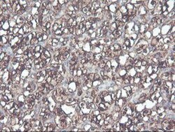 Cytosol Nonspecific Dipeptidase (CNDP2)/CPGL Antibody (OTI8A2), Novus Biologicals