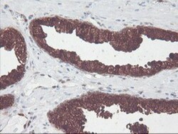 Cytosol Nonspecific Dipeptidase (CNDP2)/CPGL Antibody (OTI8A2), Novus Biologicals