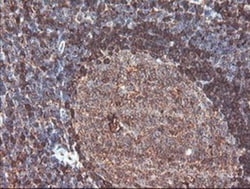 Cytosol Nonspecific Dipeptidase (CNDP2)/CPGL Antibody (OTI8A2), Novus Biologicals