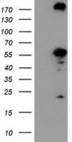 Cytosol Nonspecific Dipeptidase (CNDP2)/CPGL Antibody (OTI8A2), Novus Biologicals