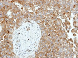 Cytosol Nonspecific Dipeptidase (CNDP2)/CPGL Antibody, Novus Biologicals