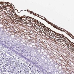 CNFN Antibody, Novus Biologicals 0.1mL; Unlabeled:Antibodies, Polyclonal